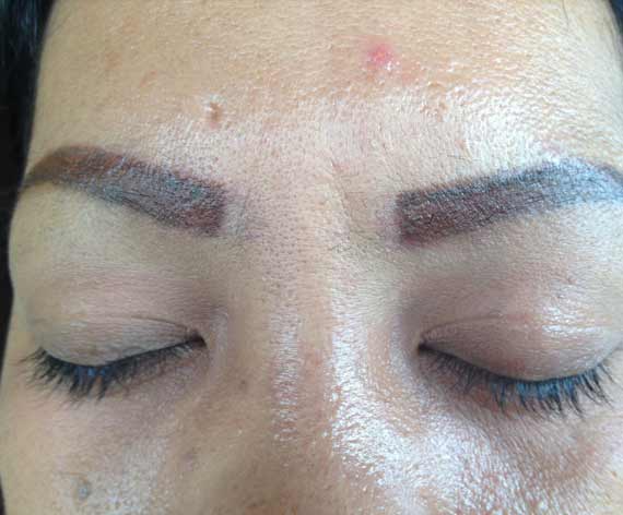 Spot/Eyebrow Removal